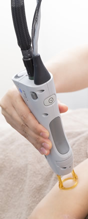 アレキサンドライトレーザー