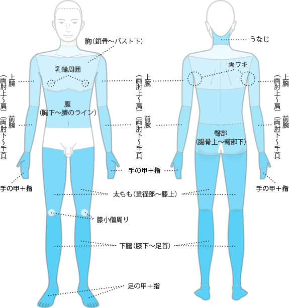 脱毛部位　全身